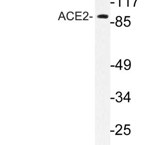 ACE2 Polyclonal Antibody
