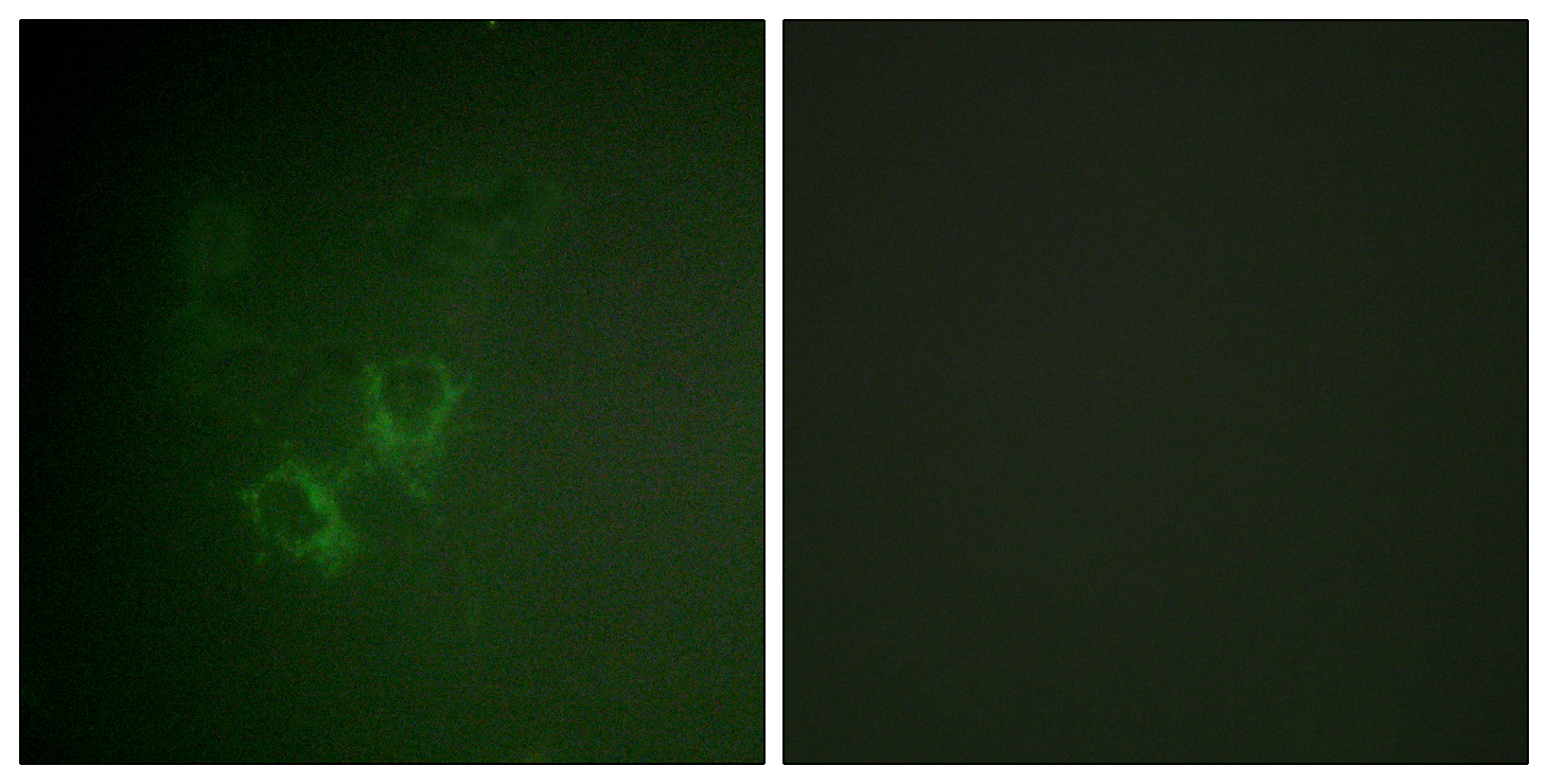 Ah Receptor Polyclonal Antibody