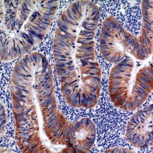 AID Polyclonal Antibody
