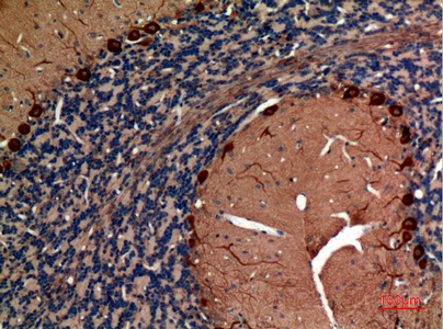 Aldolase C Polyclonal Antibody - Image 3