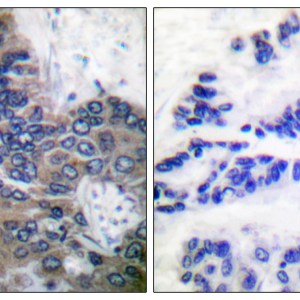 Apaf-1-ALT Polyclonal Antibody