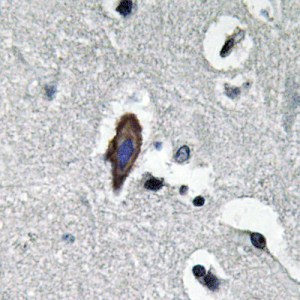 AQP0 Polyclonal Antibody