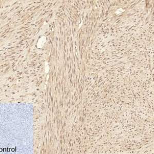 ATG7 Mouse Monoclonal Antibody (3D6)