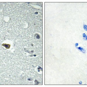 BAI1 Polyclonal Antibody