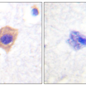 Catalase Polyclonal Antibody