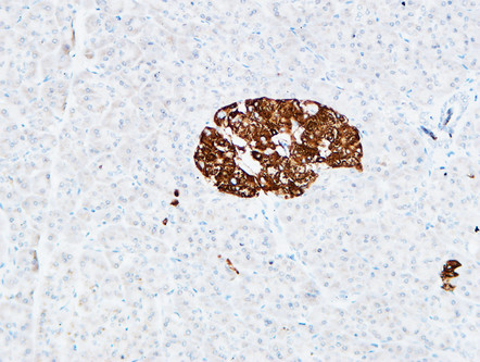 CD133 Polyclonal Antibody - Image 3
