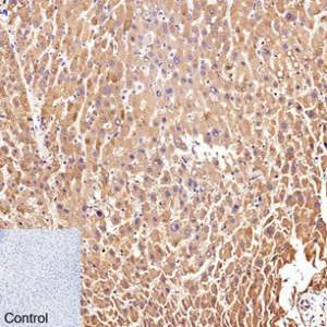 CD25 Monoclonal Antibody (Q22)