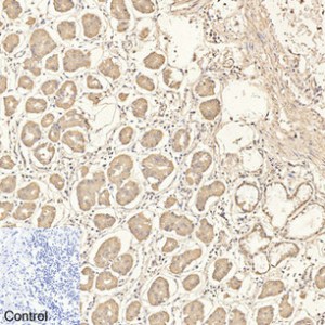 CD4 Monoclonal Antibody (11A1)