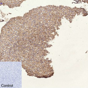 CK8 Monoclonal Antibody (8G8)