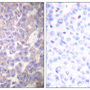 Claudin-2 Mouse Polyclonal Antibody (8H11)